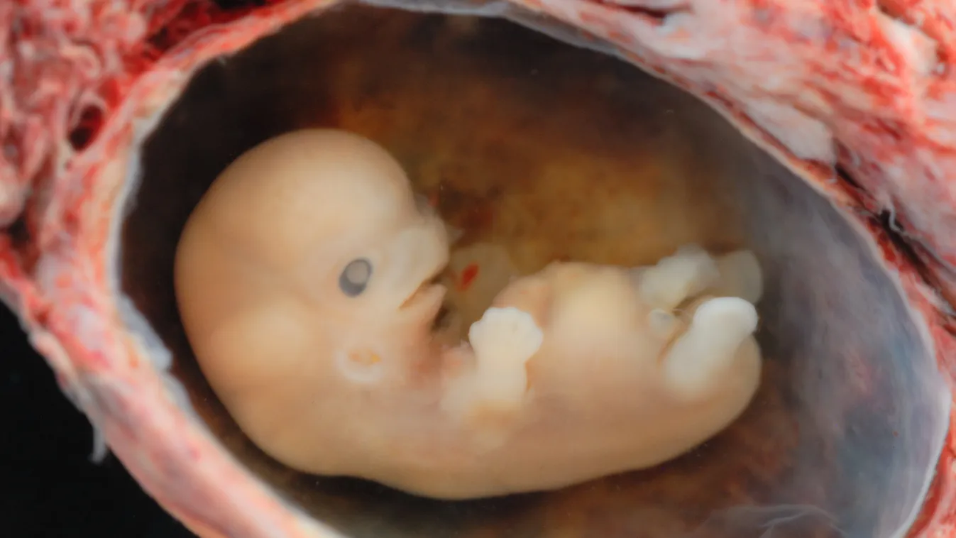 8 hetes embrió 