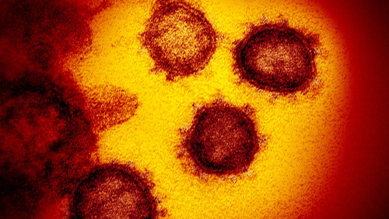 Hamilton, 2020. február 17.
Az amerikai Allergiás és Fertőző Betegségek Országos Intézete (NIAID) által közreadott,  dátumozatlan elektronmikroszkópos kép a SARS-CoV-2 nevű koronavírusról. A 2019-nCoV néven is ismert vírus egy fertőző humán koronavírus, a