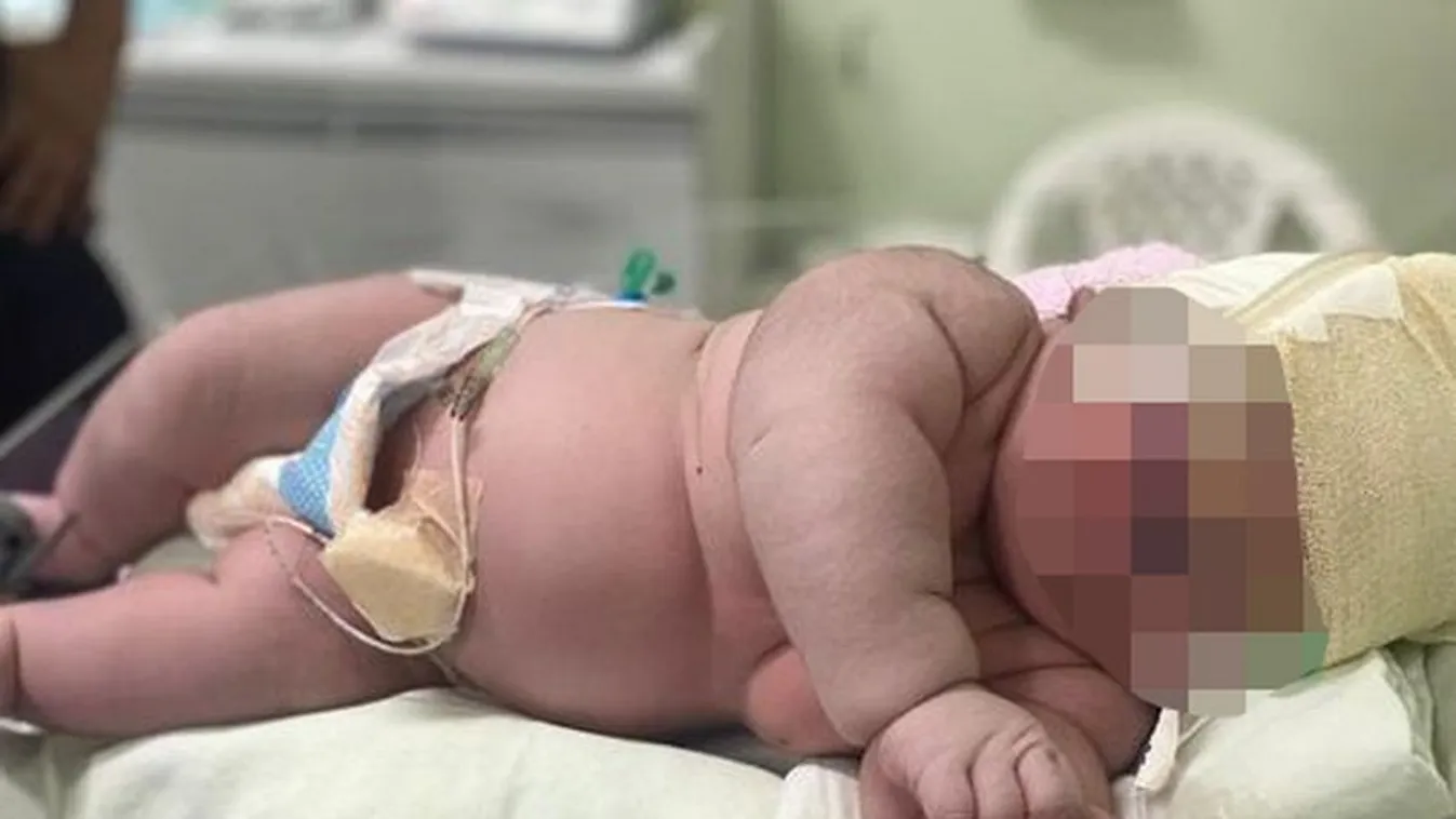 Még az orvosok is megdöbbentek: óriási méretű kisbaba született 