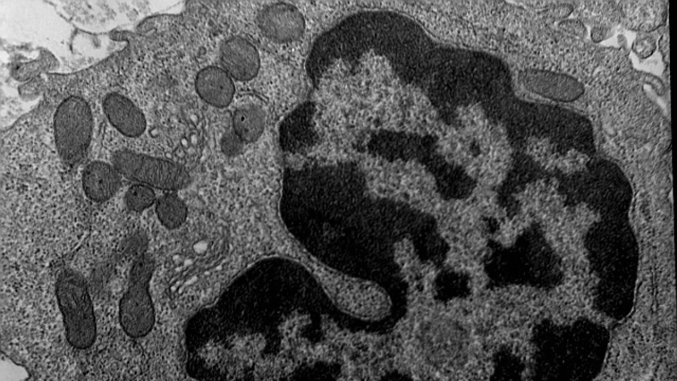 Tüdőben lévő makrofág elektronmikroszkópos képe 