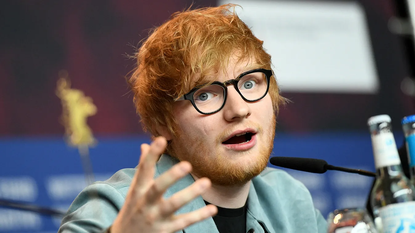 Ed Sheeran Szexi hegek: sztárok, akik nem takargatják sebhelyeiket 