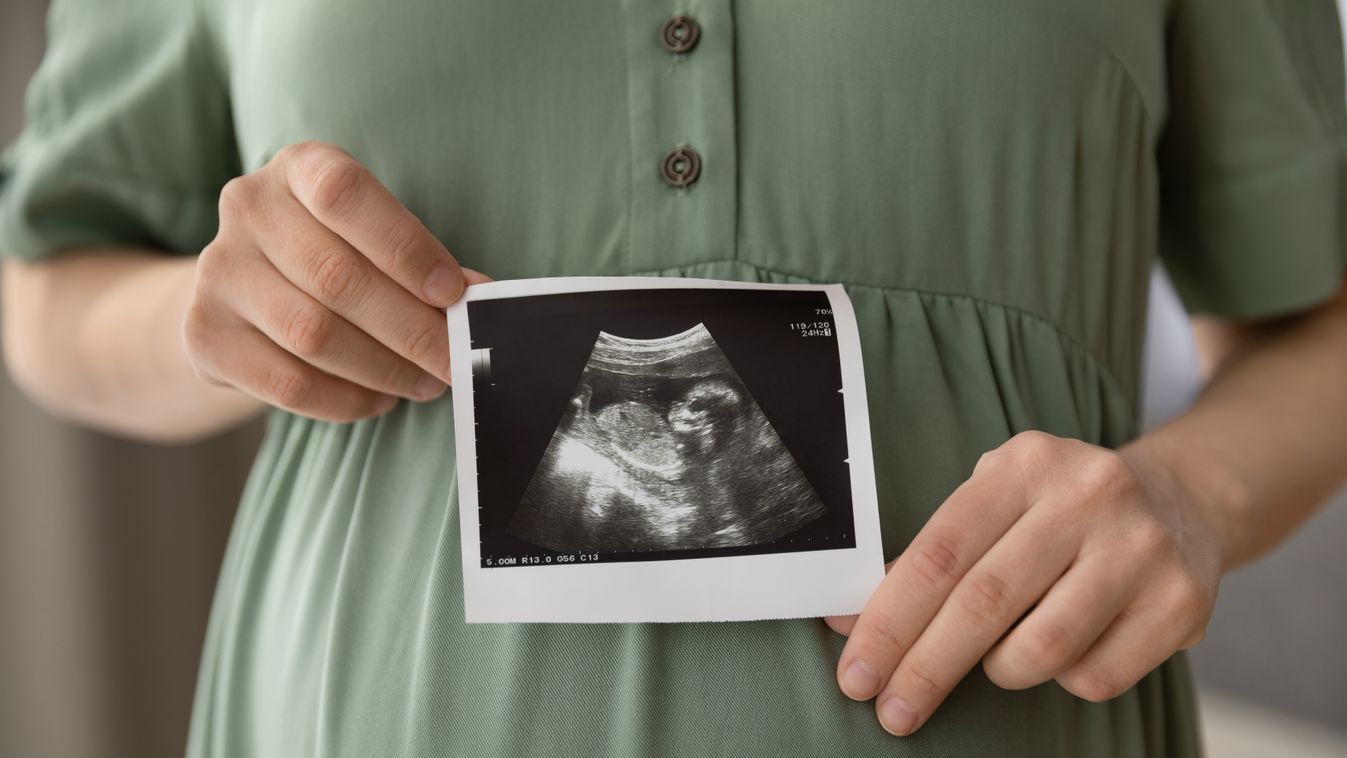 magzat ultrahangfelvétel terhes 
