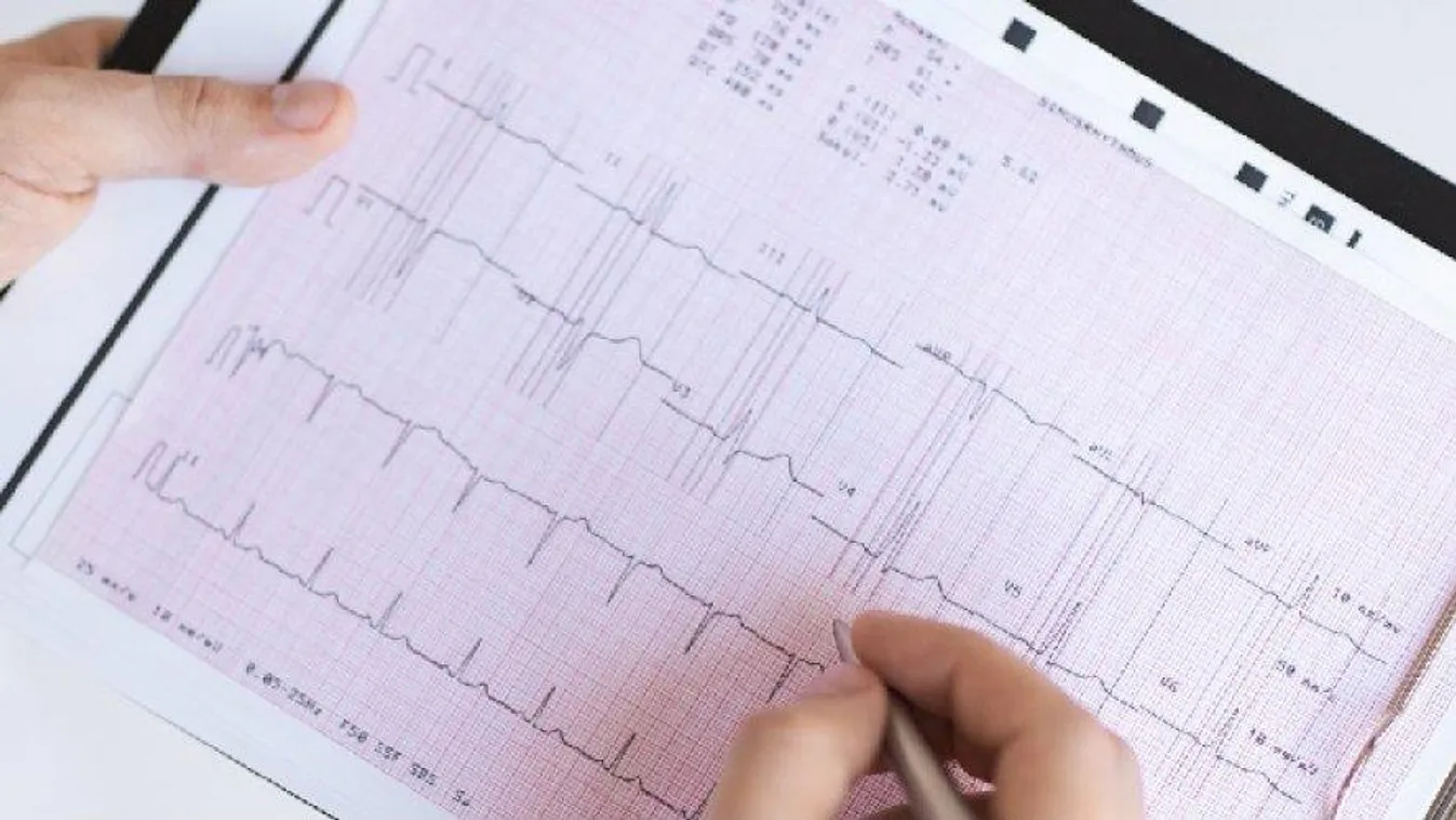 elektrokardiográfia 