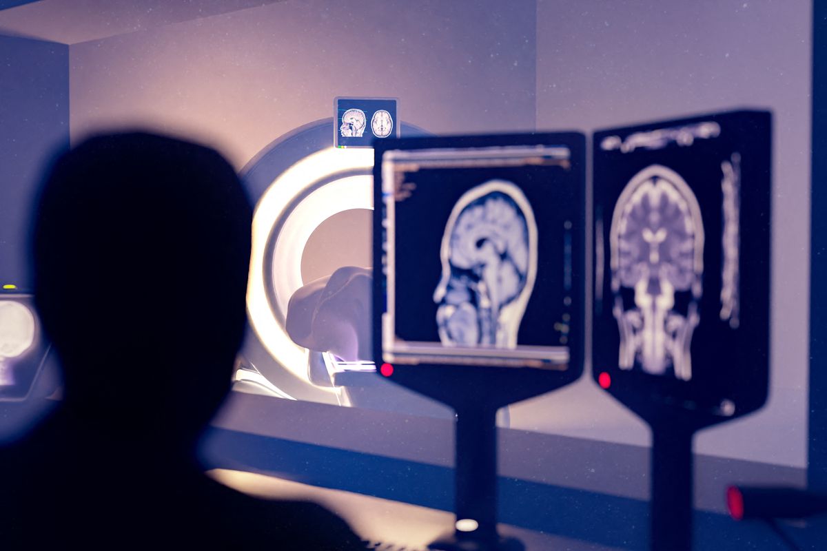 agy, brain, brain scan 