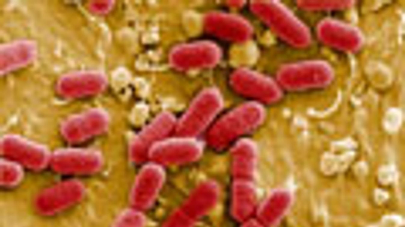 Németország, hasmenésjárvány, EHEC, E. coli, kólibaktérium