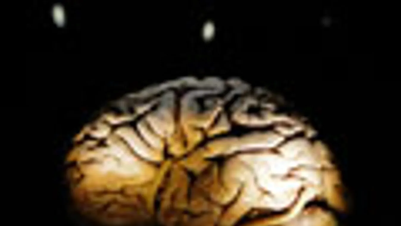 agy, vakok, agyműködés, az agy bizonyos részei képesek funkciót váltani