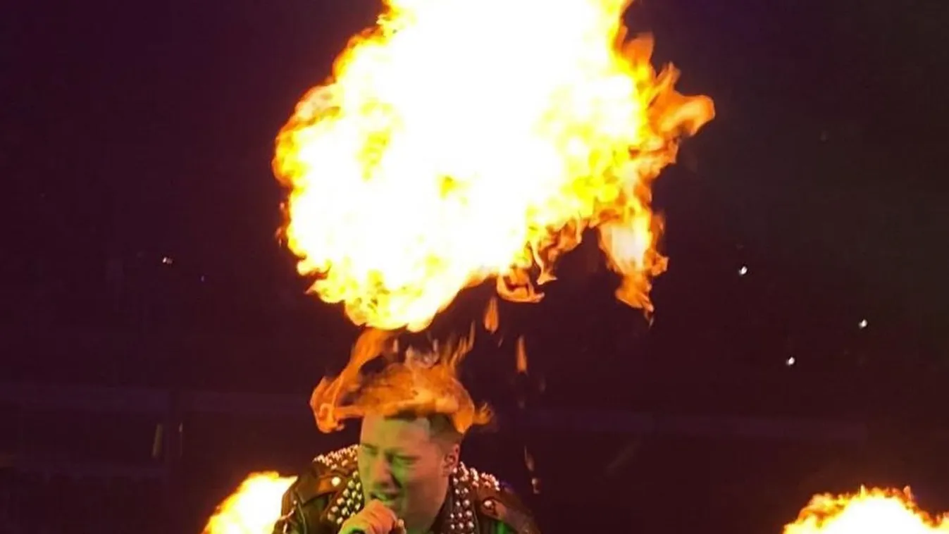 Valkusz Milán megégett a színpadon 