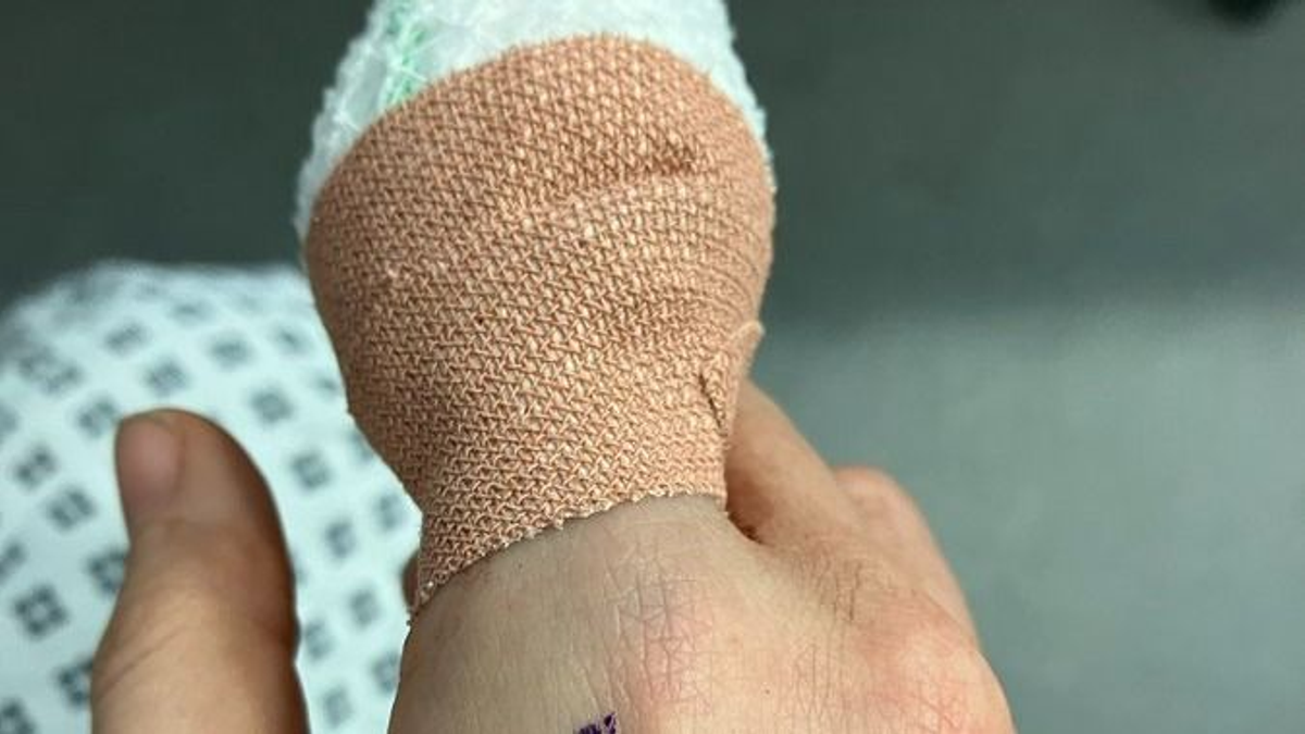 Szórólapozás közben harapta le a bristoli választáson induló jelölt ujját egy kutya - fotó