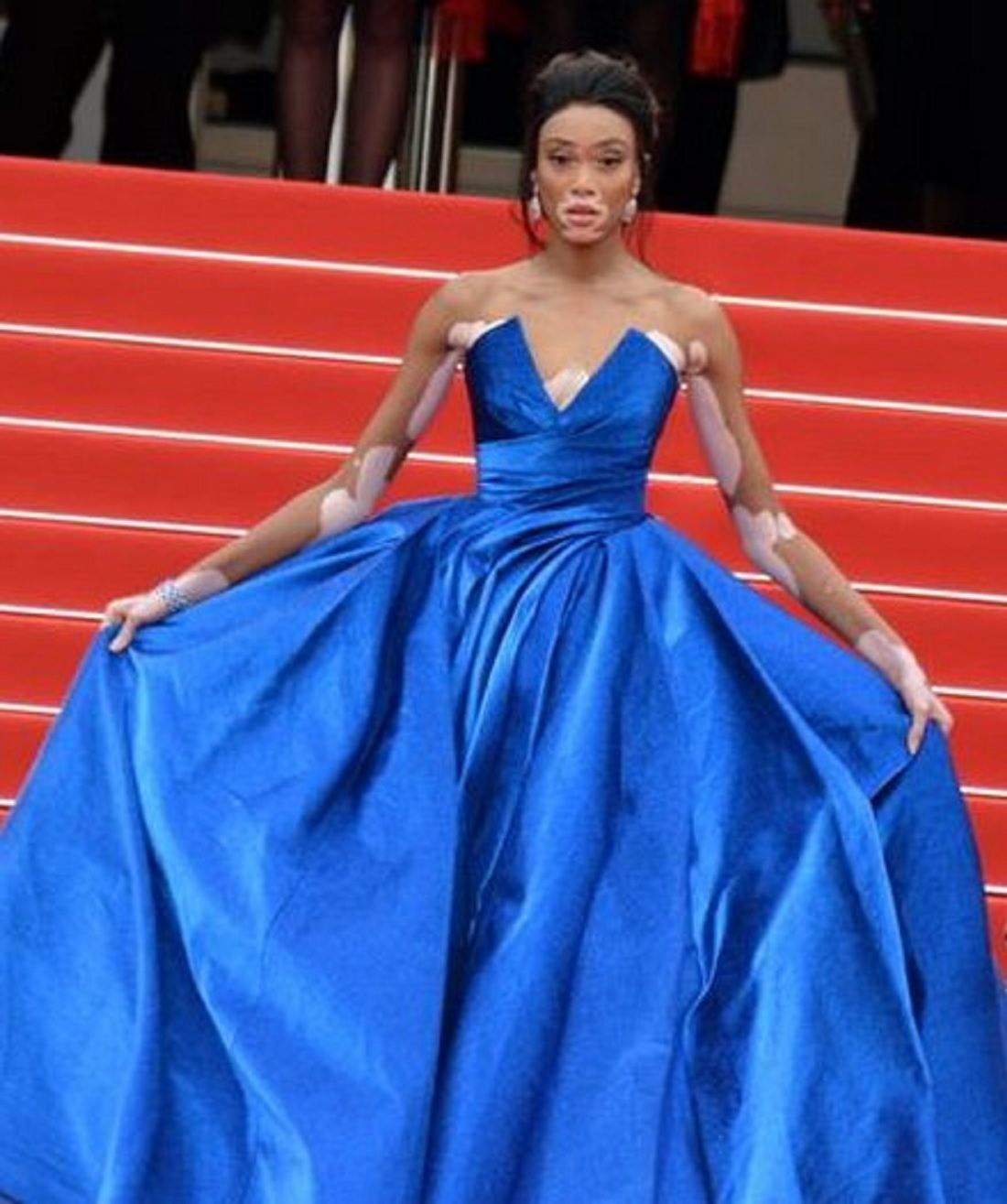 Winnie Harlow