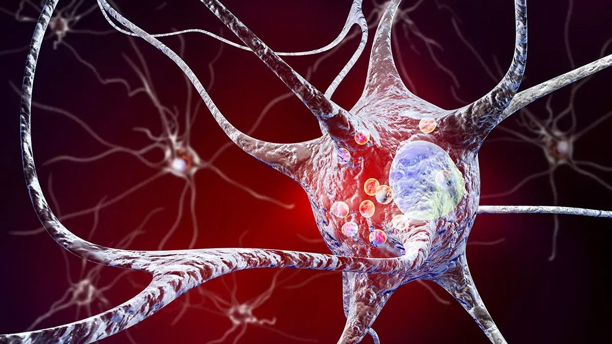 Ígéretes, új módszerek a Parkinson-kór kezelésében, magyar orvosok is dolgoznak rajta
