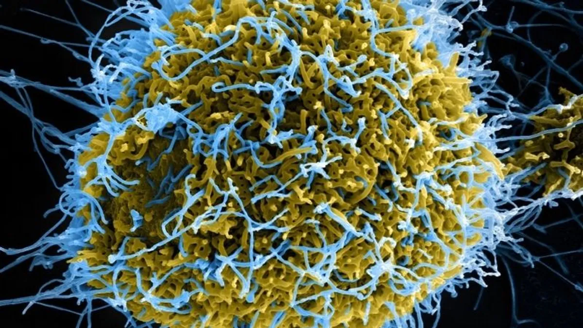 Így épül fel egy újabb, legmagasabb szintű biobiztonsági laboratórium