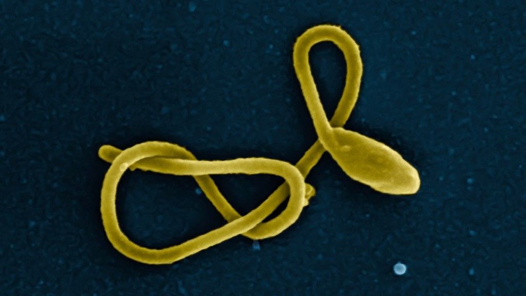 Ebola