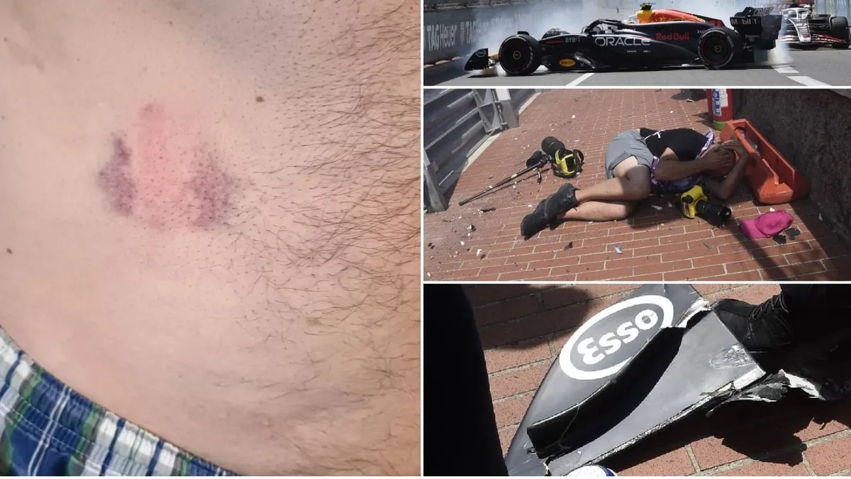 Vérfagyasztó videó a Monacói Nagydíj balesetéről, egy fotós megsérült