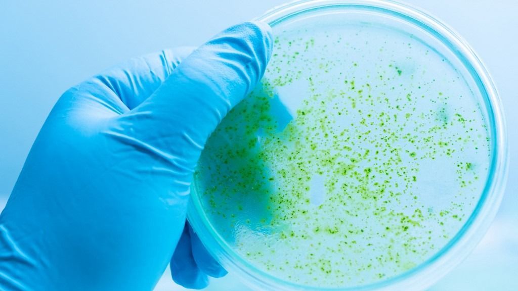 Petri dish with cyanobacteria Cianobaktérium