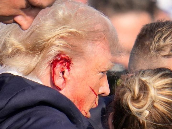 Donald Trump, DonaldTrump, merénylet, lövés, kampány, alatt, meglőtték, vérzik, fül, fülön lőtték Trumpot, 2024. 07. 13.