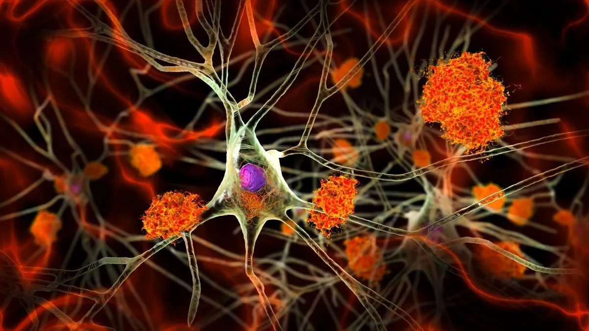 Alzheimer-kór: a tanácsokat betartva nem leszünk betegek