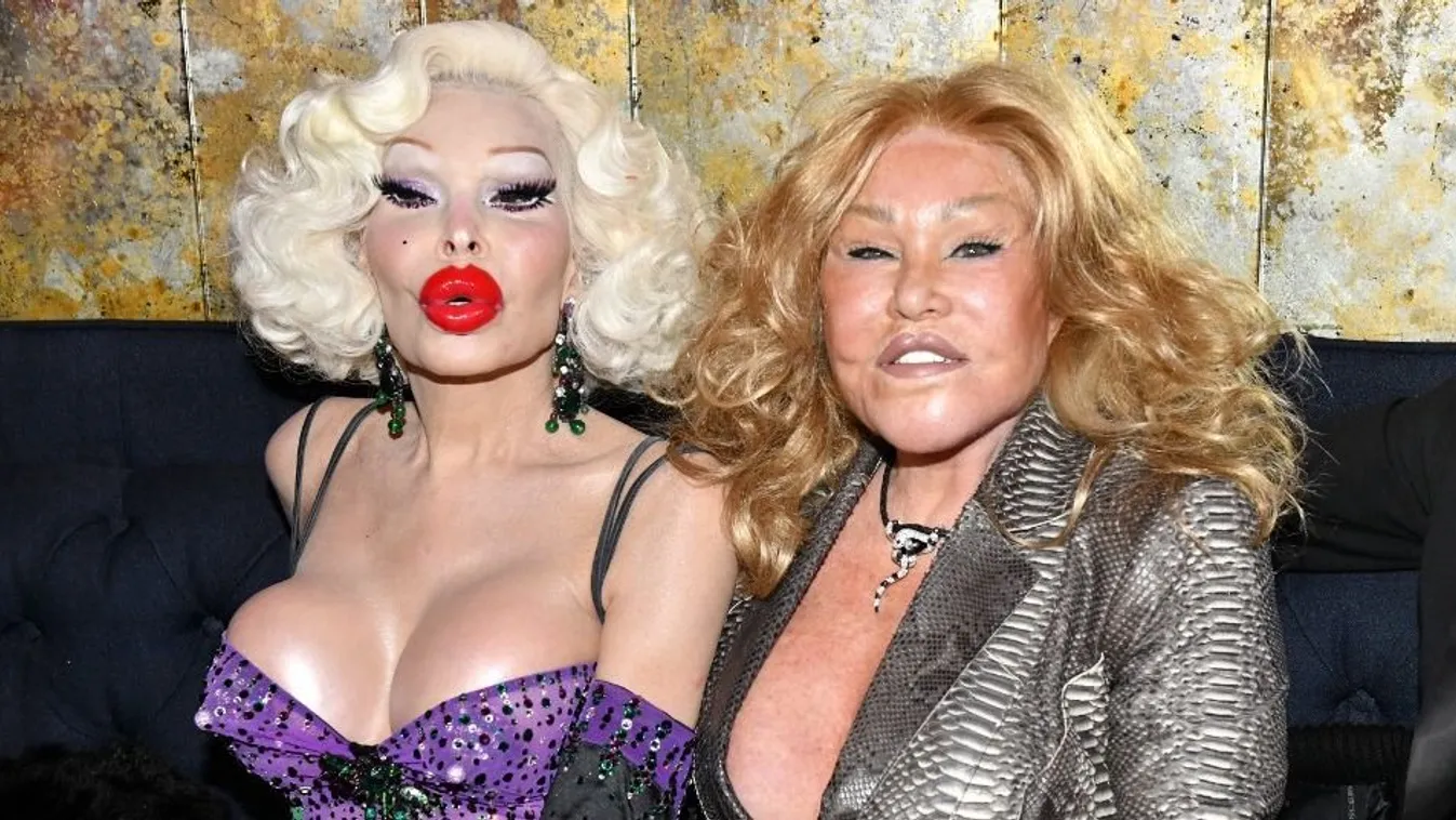 Plasztikai műtétek után: Amanda Lepore és Jocelyn Wildenstein 