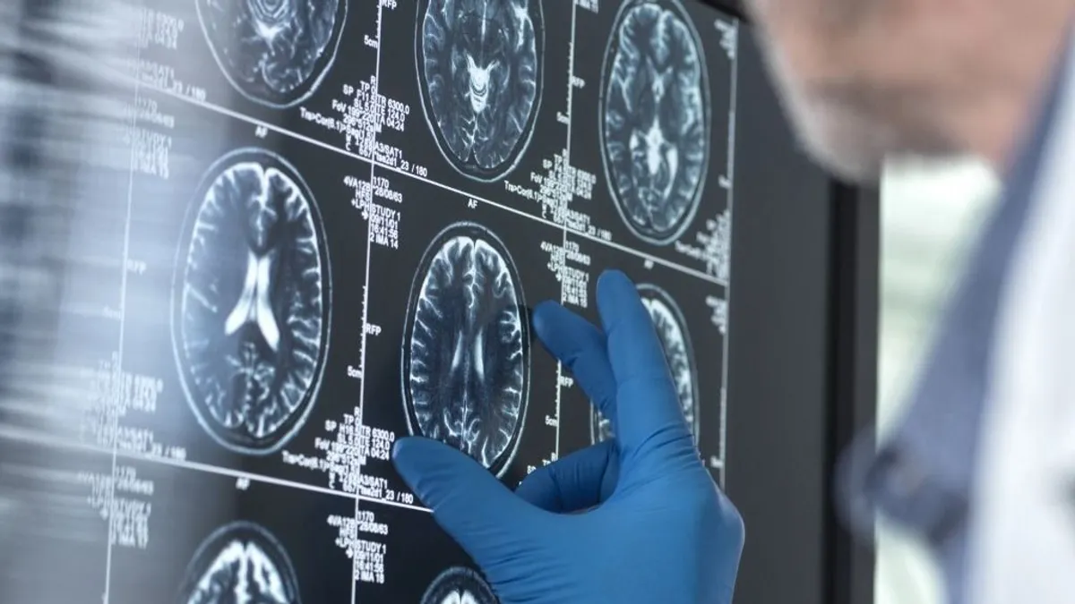 Új tényező fokozhatja az Alzheimer-kór kockázatát