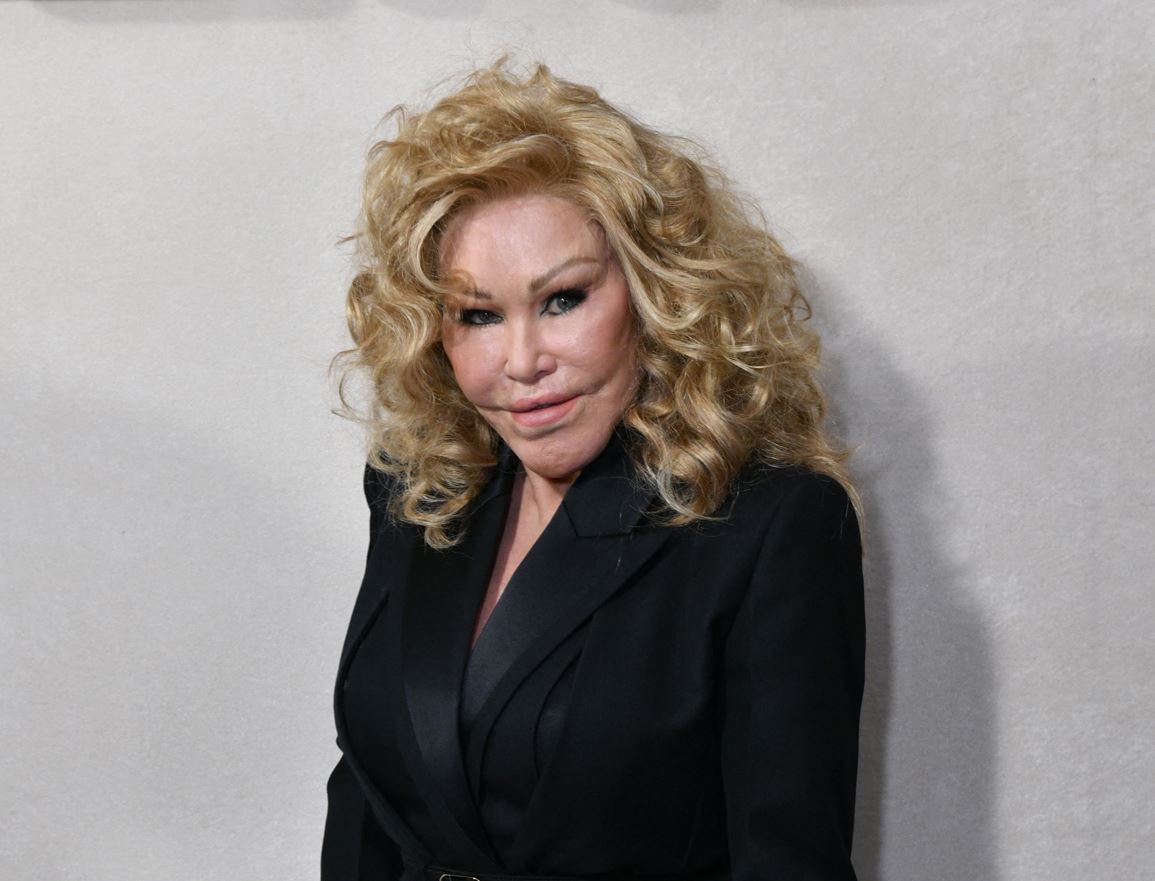 Plasztikai műtétek után: Jocelyn Wildenstein