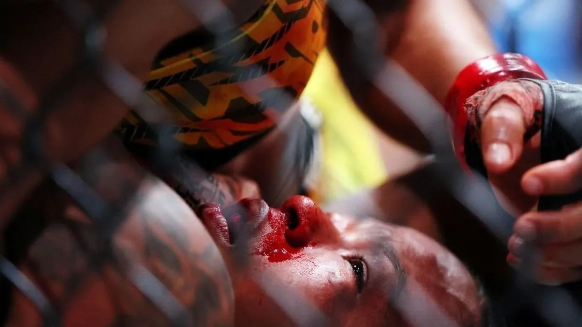 Úgy fejbe rúgták az UFC harcosát, kórházba kellett vinni - videó