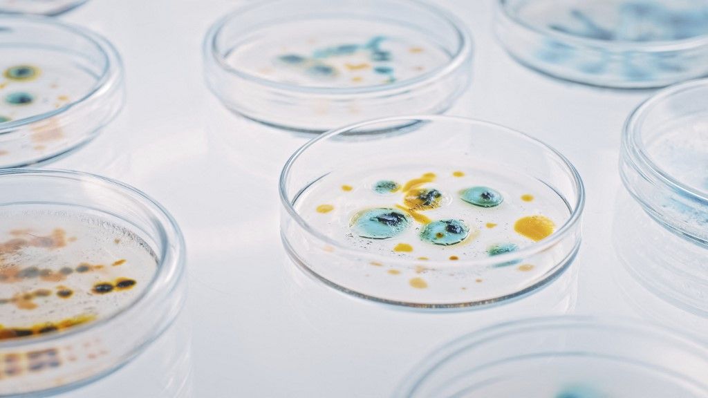 Bacteria samples in petri dishes