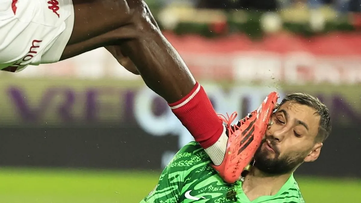 Donnarumma arcát brutális fejrúgás után össze kellett varrni