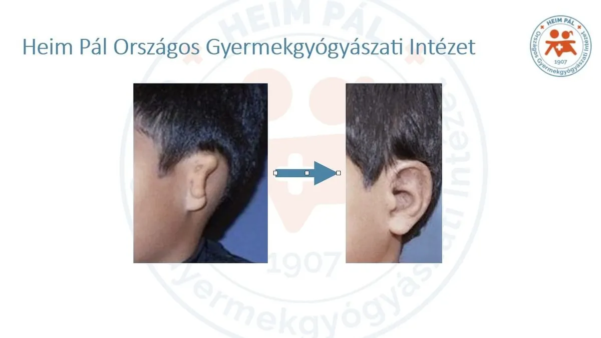 Forradalmi áttörést ért el a Heim Pál gyermekkórház