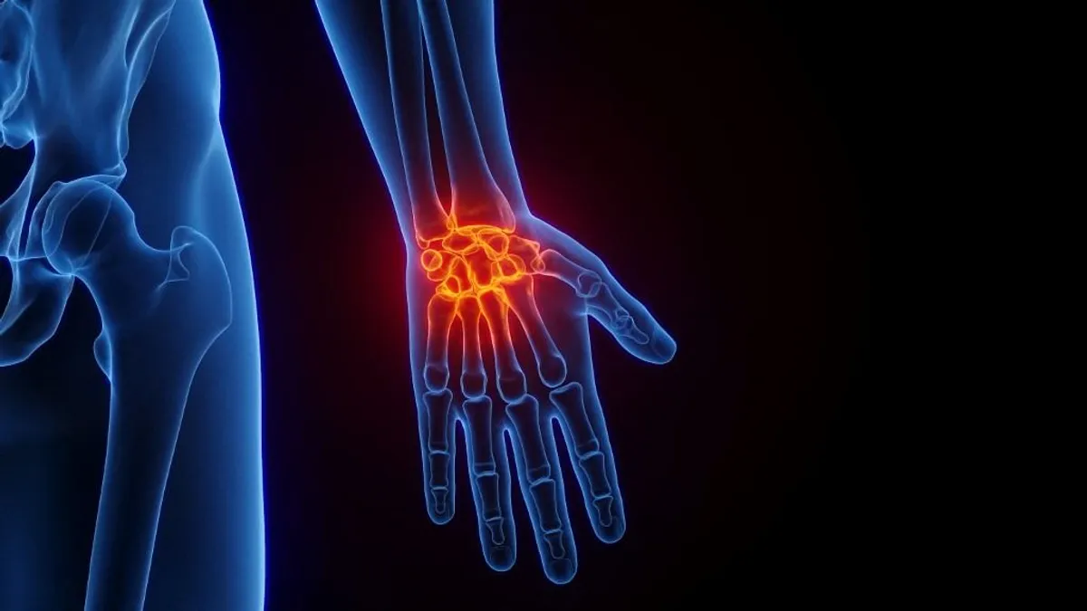 Rheumatoid arthritis: ezek a legjellemzőbb tünetek