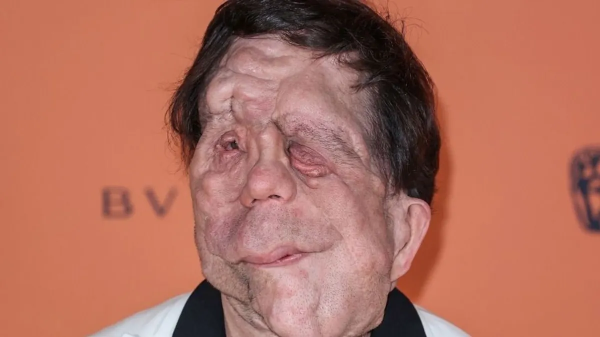 Adam Pearson és Sebastian Stan könnyekig hatott mindenkit