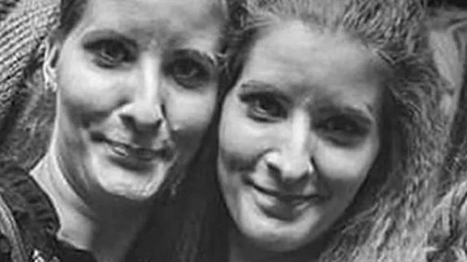 eltűnt ikrek, Skócia