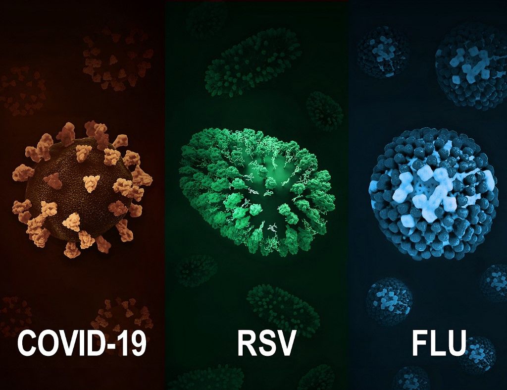 influenza