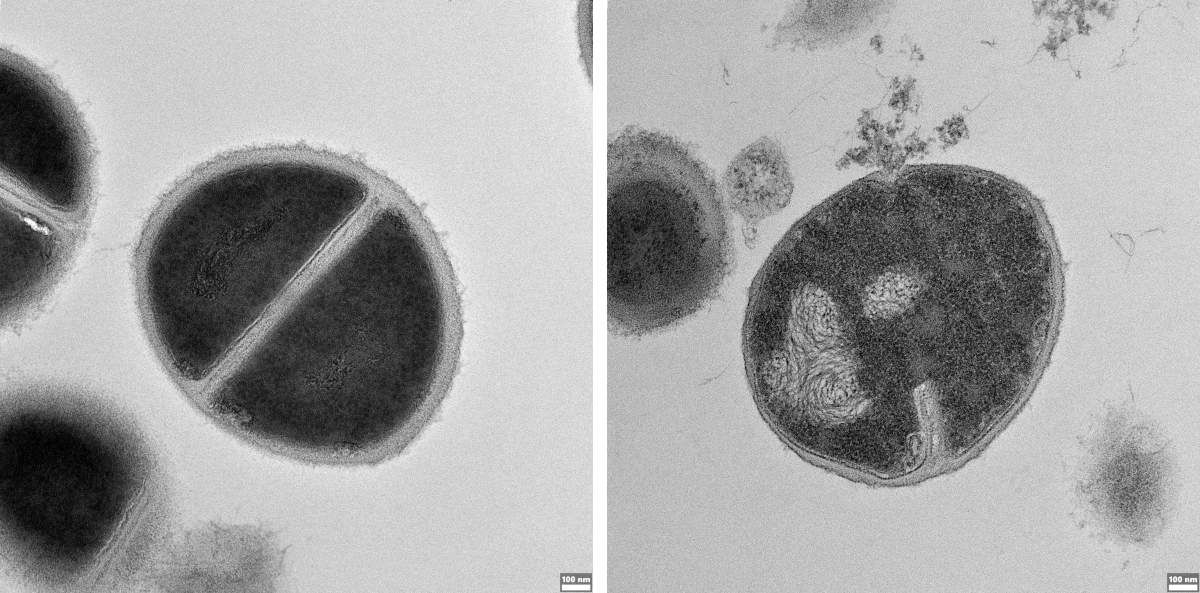 Emberi fertőzést okozó Staphylococcus baktériumok. Balra: kezeletlen baktériumok tenyészete. Jobbra: egy baktériumsejt, amelyet a proteaszóma által termelt antimikrobiális peptid pusztított el.