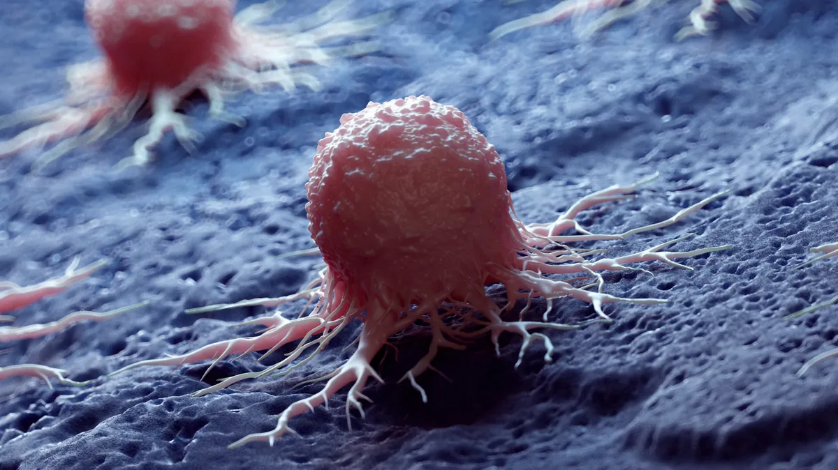 Cancer cell, illustration. (Photo by 3DMEDISPHERE/SCIENCE PHOTO LIBRA / SKX / Science Photo Library via AFP)