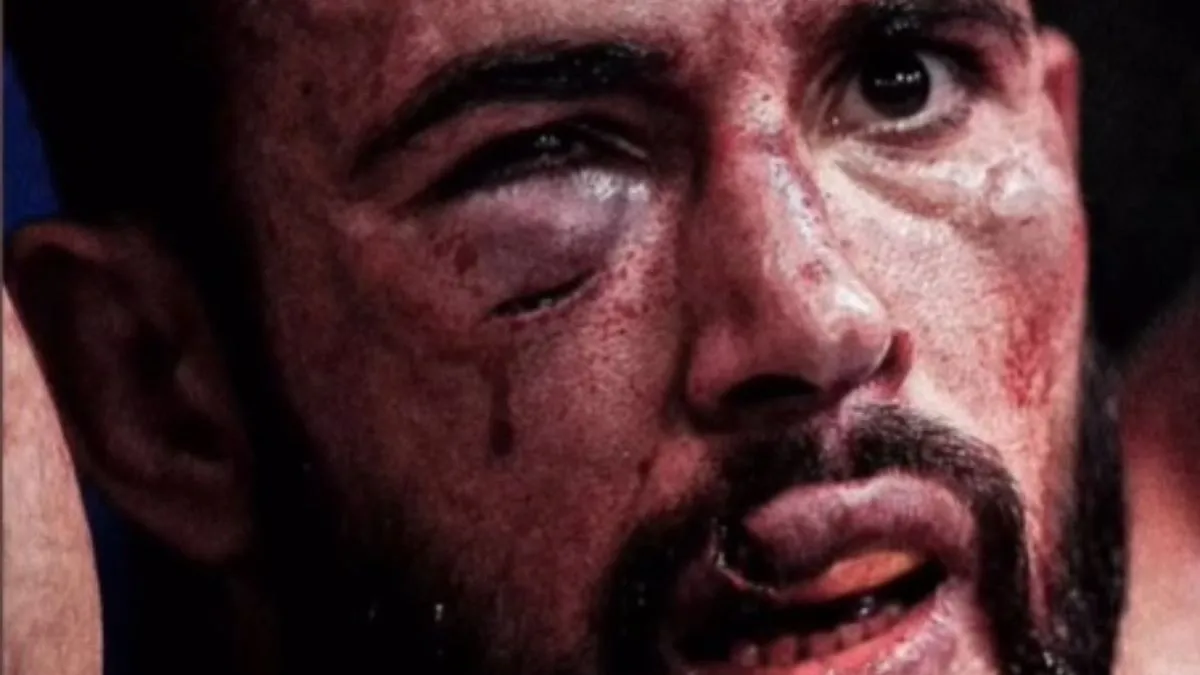 „Vért köpött" – brutális sérüléseket szenvedett a UFC-sztár – videó