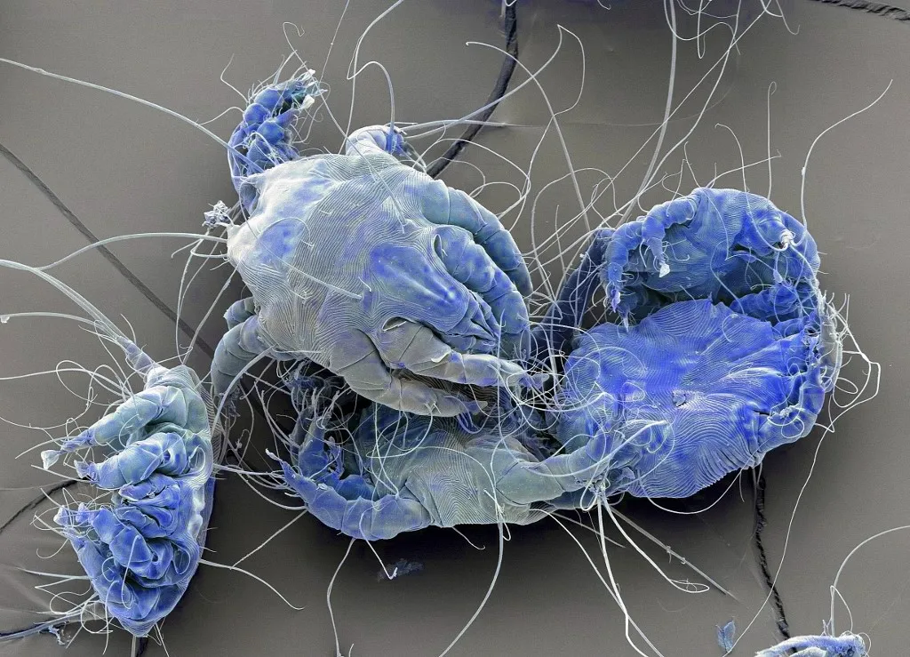 Dust mites. Coloured scanning electron micrograph (SEM) of house dust mites (Dermatophagoides pteronyssinus). Millions of dust mites inhabit the home, feeding on shed skin cells. They mainly live in furniture, and are usually harmless. However, their excrement and dead bodies may cause allergic reactions in susceptible people. The dust mite life cycle from egg to adult takes approximately one month to complete, mature female mites can lay from 1-2 eggs per day. Adult mites can live up to two months. Magnification: x60 when printed at 10 centimetres wide. (Photo by STEVE GSCHMEISSNER/SCIENCE PHOTO / SGS / Science Photo Library via AFP)