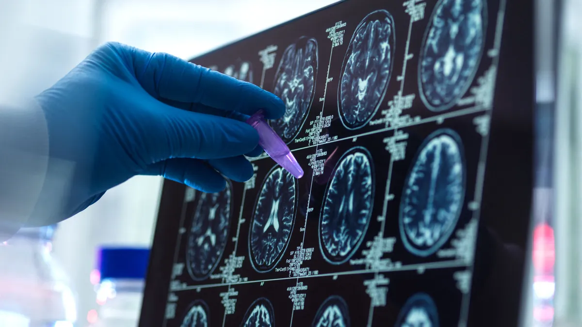 Ezzel a pofonegyszerű módszerrel megelőzhető az Alzheimer-kór