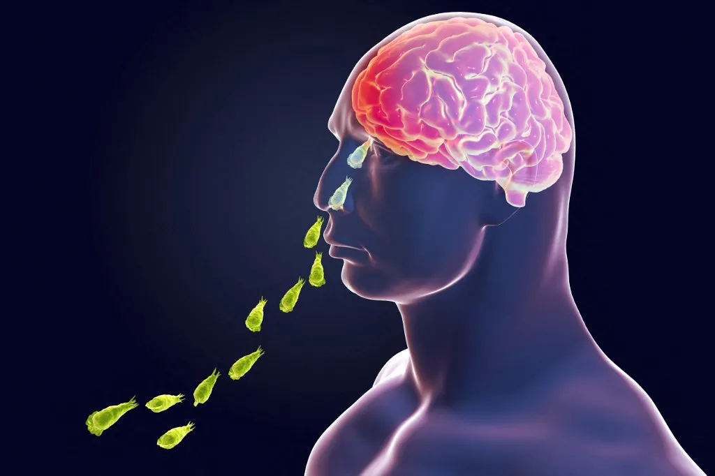 Brain-eating amoeba infection. Computer illustration of Naegleria fowleri protozoans infecting the brain. This organism is an opportunistic pathogen of humans, causing meningoencephalitis (inflammation of the brain and its surrounding membranes) when inhaled, often by children swimming in fresh water. Headaches, vomiting, sensory disturbance and a fatal coma may occur if the victim is not treated. Treatment is with antiprotozoal drugs. (Photo by KATERYNA KON/SCIENCE PHOTO LIBRA / KKO / Science Photo Library via AFP)