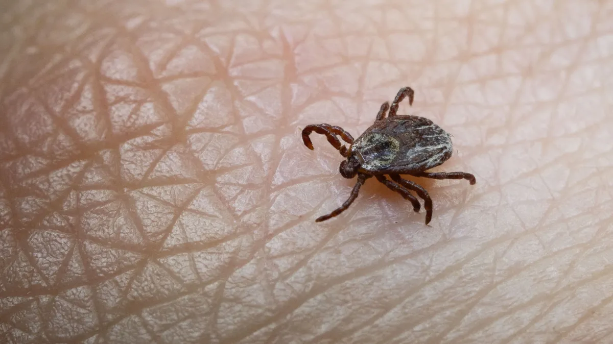 Ezt mindenképpen tegye meg, ha kullancs fúródik a bőrébe