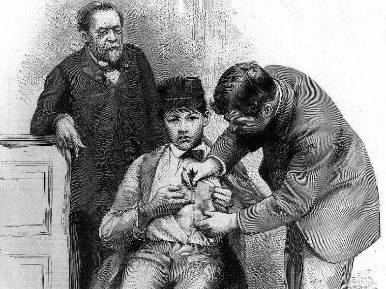 veszettség Vaccination contre la rage : inoculation du virus rabbique au berger Jupille, dans le laboratoire de Louis Pasteur (1822-1895), chimiste et biologiste français, à gauche. Gravure (1886).     HRL-634242 (Photo by © Harlingue / Roger-Viollet / Roger-Viollet via AFP)