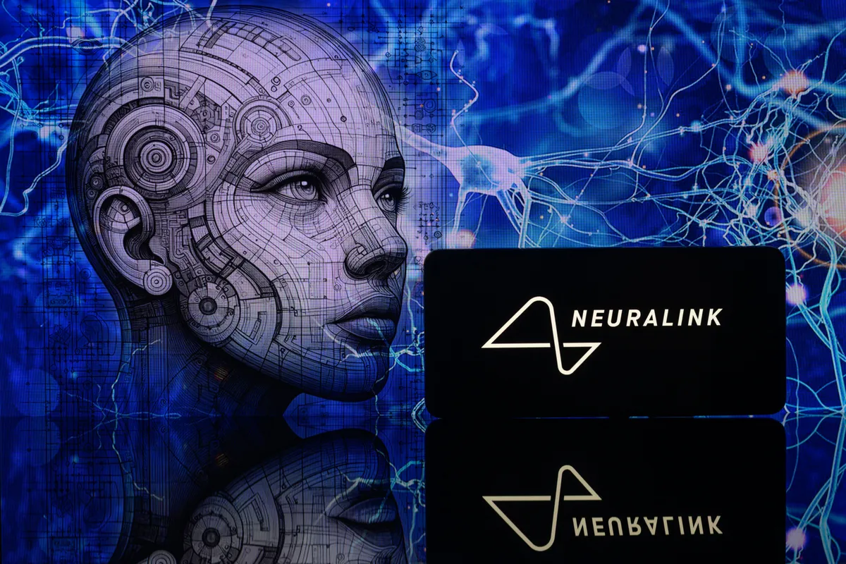 A Neuralink implantátum gondolatvezérléssel teszi lehetővé a kurzor irányítását a bénult páciensek számára.
