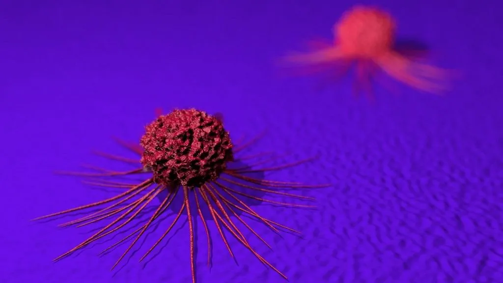 Rák elleni harcban kulcsszerepe lehet a rendszeres testmozgásnak (illusztráció)ráksejt Cancer cells. Computer illustration of a cancer cell. Most cells of the body have the potential to become cancerous. Cancer cells divide rapidly in a chaotic manner and often clump together to form tumours, which may invade and destroy surrounding tissues. These cells have extended many thread-like cytoplasmic processes from their surfaces. (Photo by ALFRED PASIEKA/SCIENCE PHOTO LIB / APA / Science Photo Library via AFP)