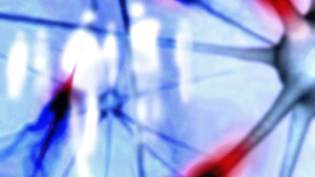 altató Conceptual computer artwork depicting Alzheimer's disease and other brain disease. (Photo by PASIEKA / APA / Science Photo Library via AFP)