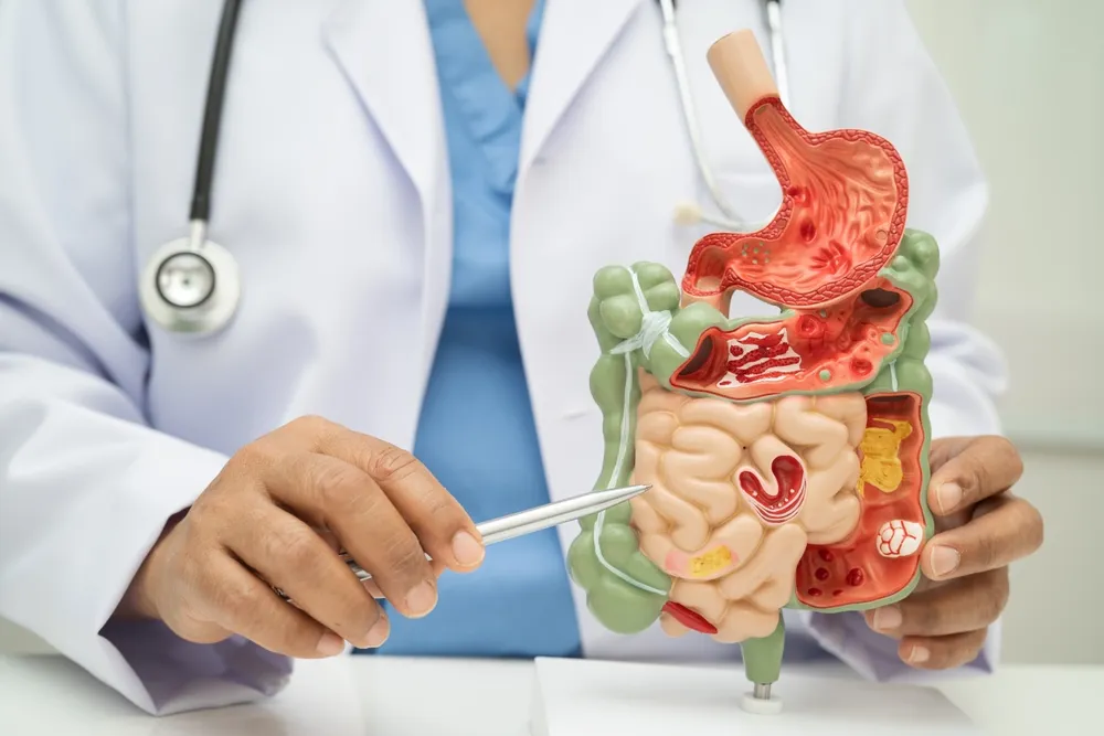 Gyors vagy lassú az emésztése? Mutatjuk, hogyan halad végig a táplálék a szervezetben, és milyen ételek gyorsítják vagy lassítják a folyamatot