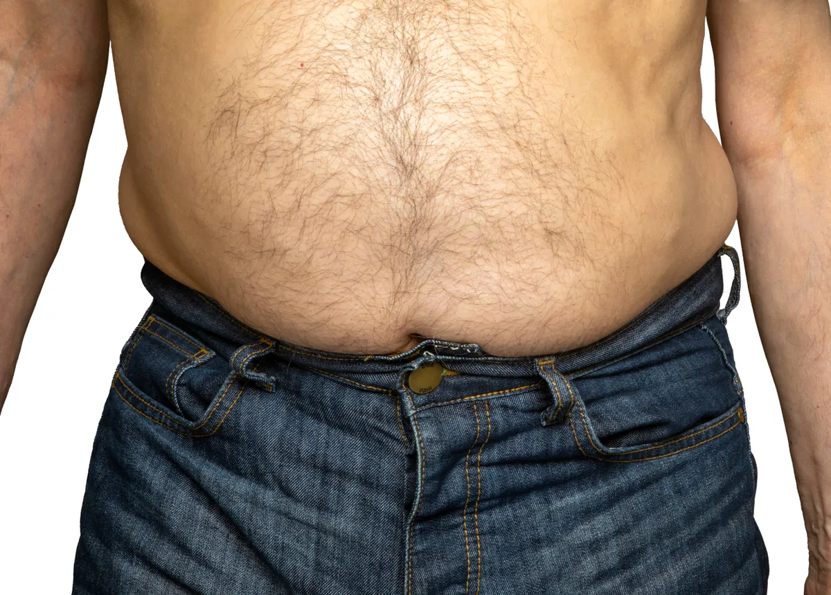 Elhízott embereknél a rákellenes vitamin védőhatása nem érvényesül.