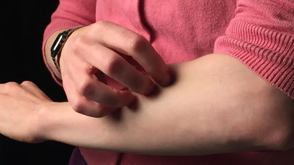 Durván nő az allergia miatti panaszok száma