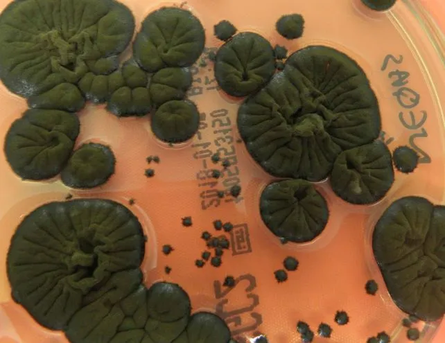 Petri-csészében növesztett Cladosporium sphaerospermum.