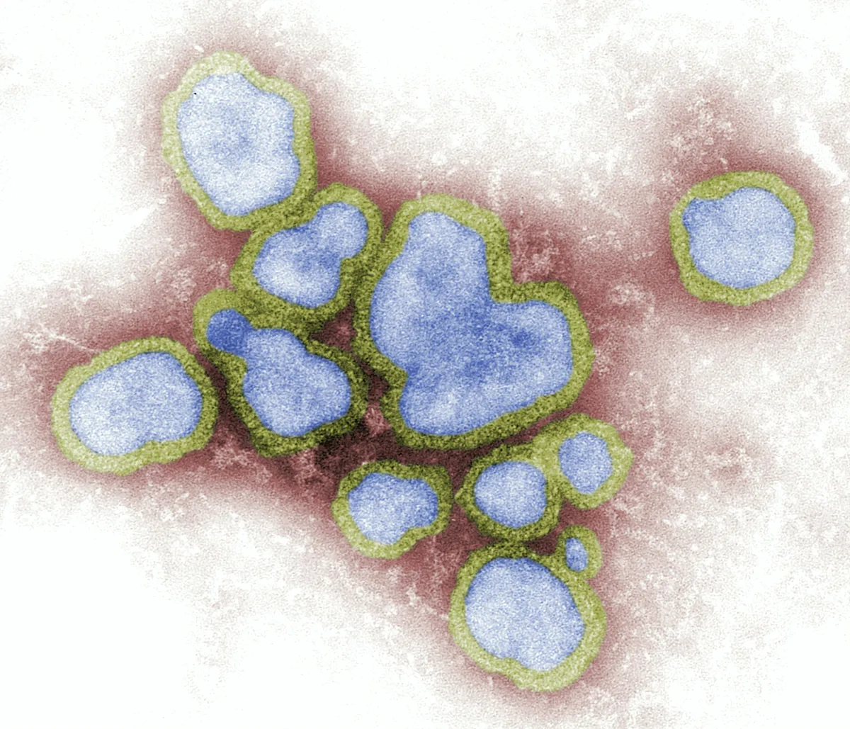 A szuperinfluenza terjedése miatt sok rendelő megtelt: az idei mutált vírust erősebb tünetek és gyorsabb fertőzés jellemzi.