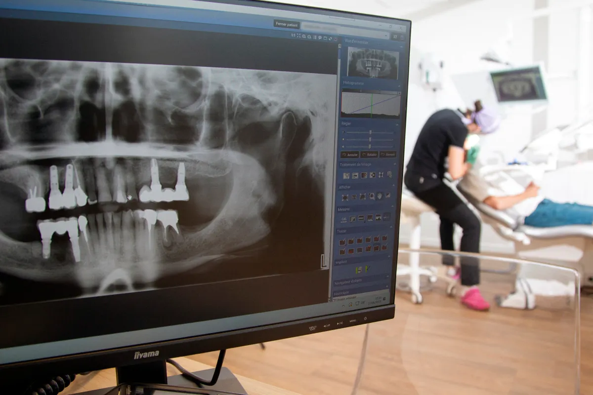 A gyógyszerrel történő fogvisszanövesztés hamarosan valósággá válhat.