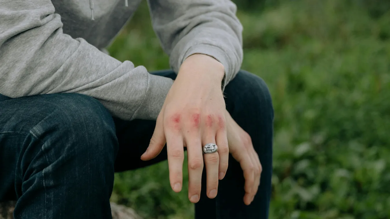 Videón a brutális bántalmazás: ütötték-verték társai a pápai diákot Kép