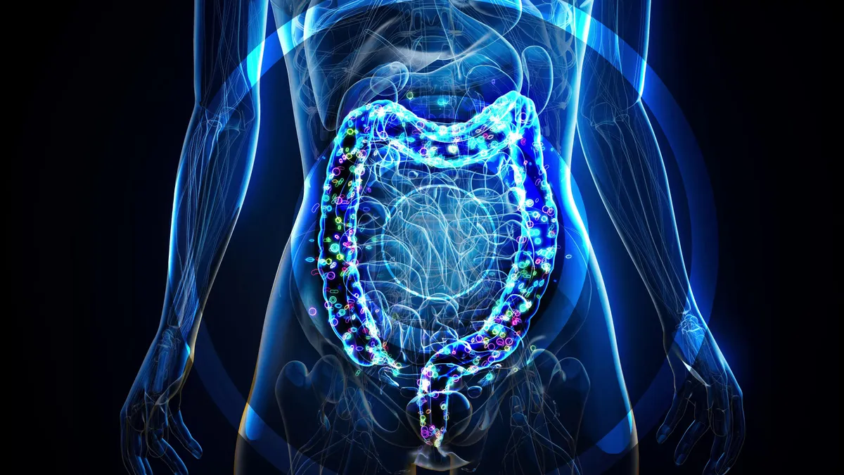 A CAG-170 bélbaktérium jelenlétét a Cambridge-i Egyetem kutatói azonosították, akik szerint ez a mikroorganizmus-csoport következetesen megjelenik az egészséges népesség körében a világ minden táján.